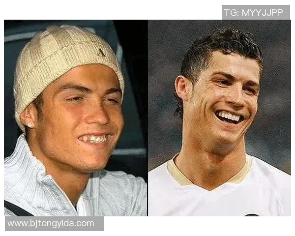 足球明星正畸全过程揭秘与精彩瞬间汇总视频合集